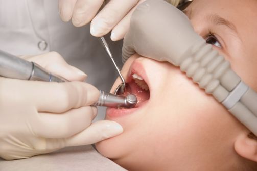 Nitrous Oxide or Laughing Gas Nitrous Oxide or Laughing Gas