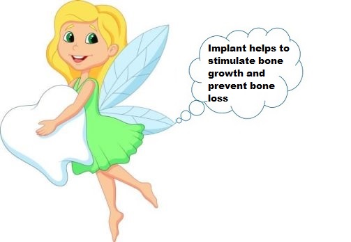 Sugar Grove Implant dentistry Sugar Grove Implant dentistry